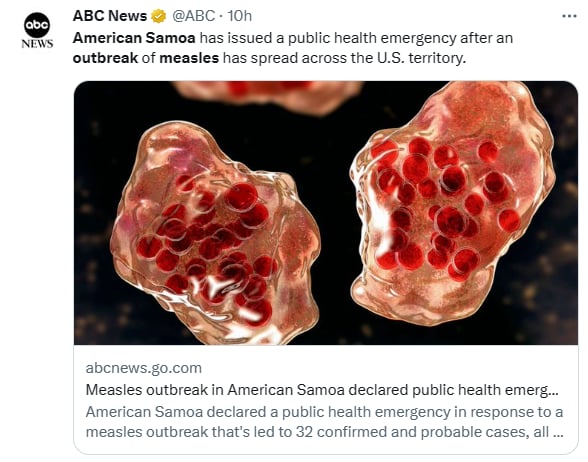 Brote sarampión Samoa Americana