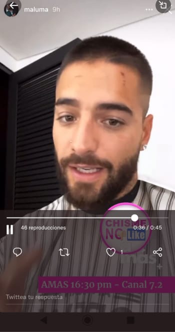 Maluma shows doberman wounds