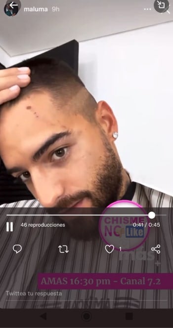 Maluma shows doberman wounds