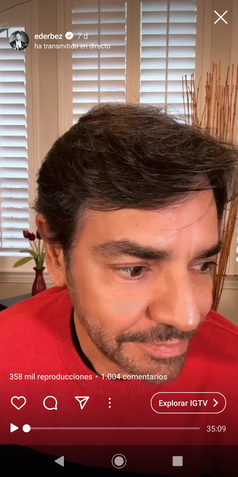 Eugenio Derbez brazo lesionado