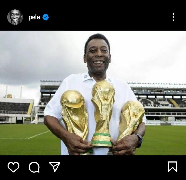 Xuxa exnovia de Pelé