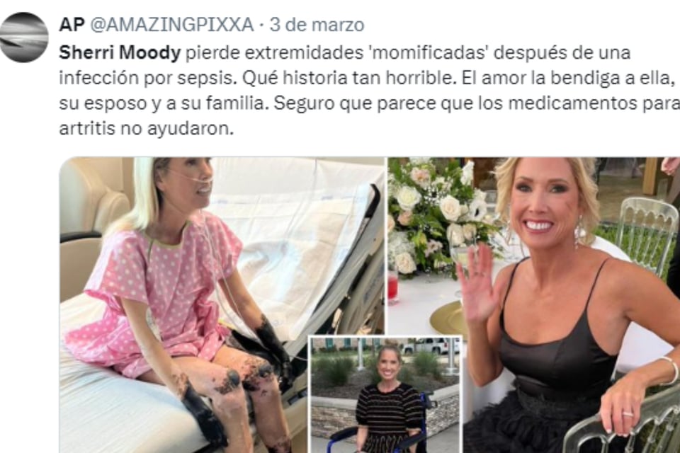  desafíos, infección, choque séptico, familia, mundonow