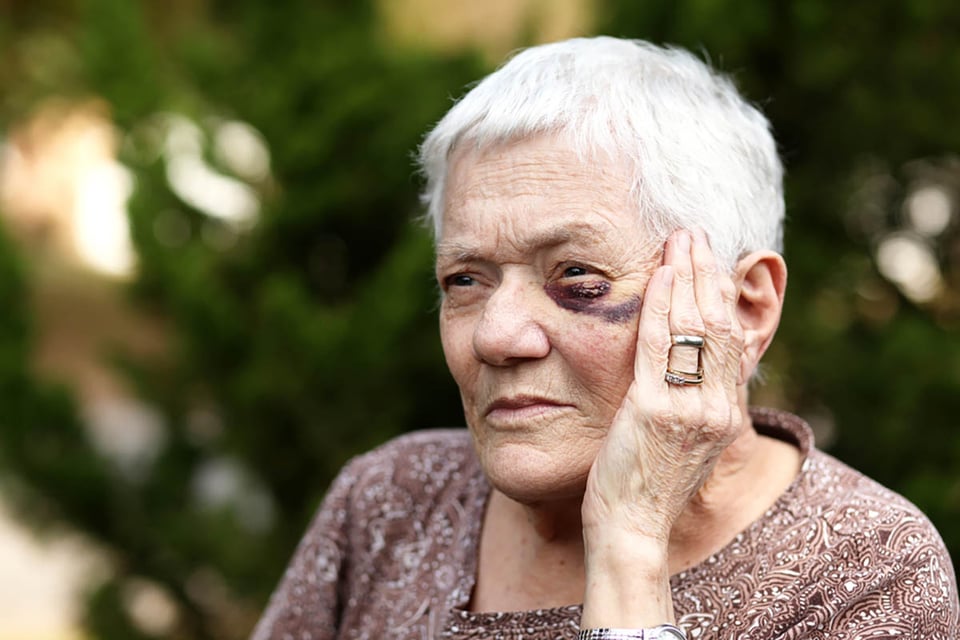 señales de abuso a personas mayores, signos de abuso de personas mayores, ancianos, personas mayores, ojo morado, mujer, señales de abuso a personas mayores