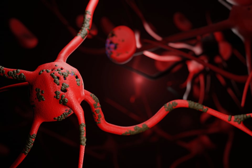 bacteria, campylobacter jejuni, síndrome, Guillain-Barré, MundoNOW