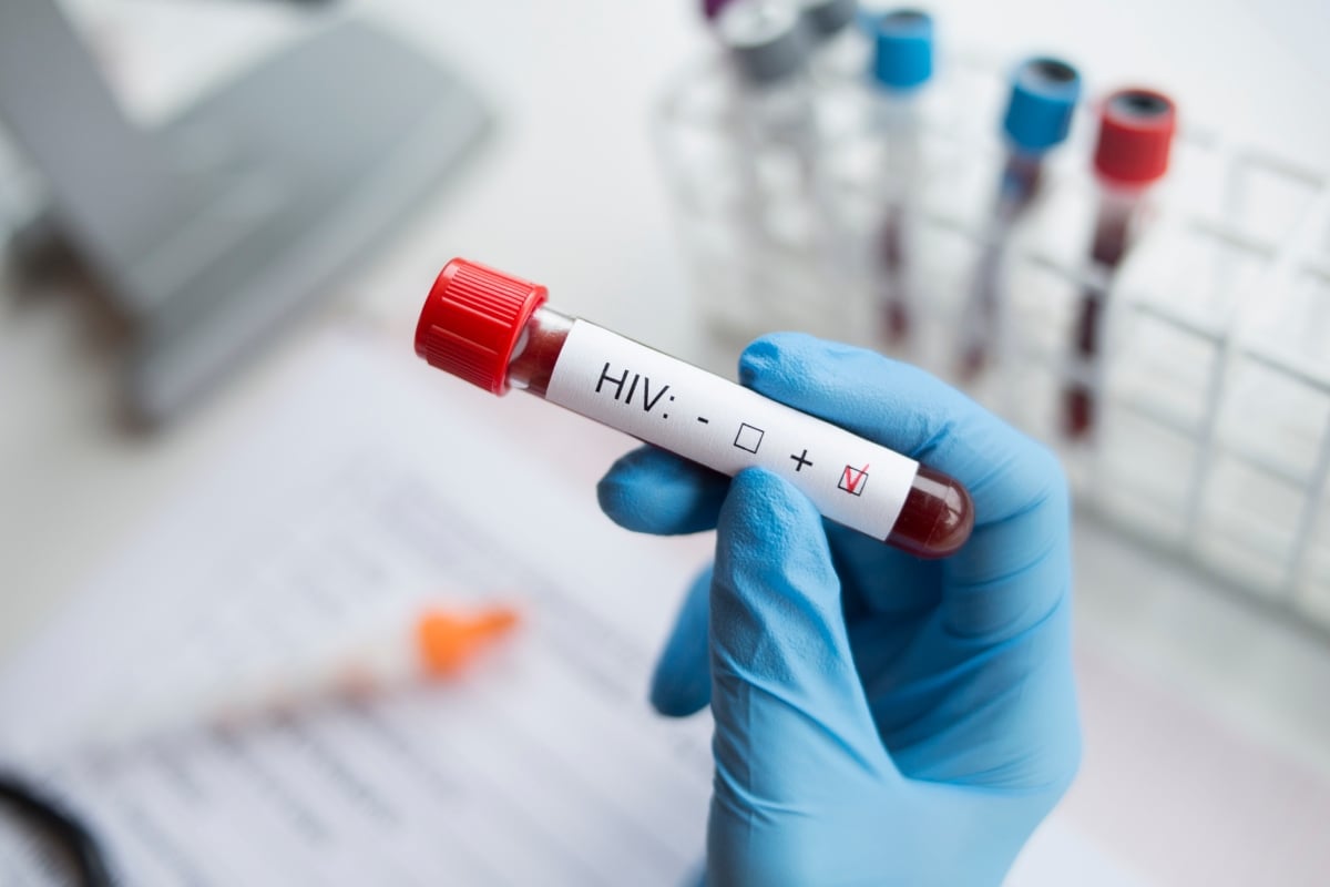 HIV Exposure Alert in Ohio, Infection, sex worker,-VIH, Infección, trabajadora sexual, Ohio, MundoNOW