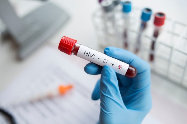 Health alert in Ohio after a sex worker with HIV had sexual contact with more than 211 people