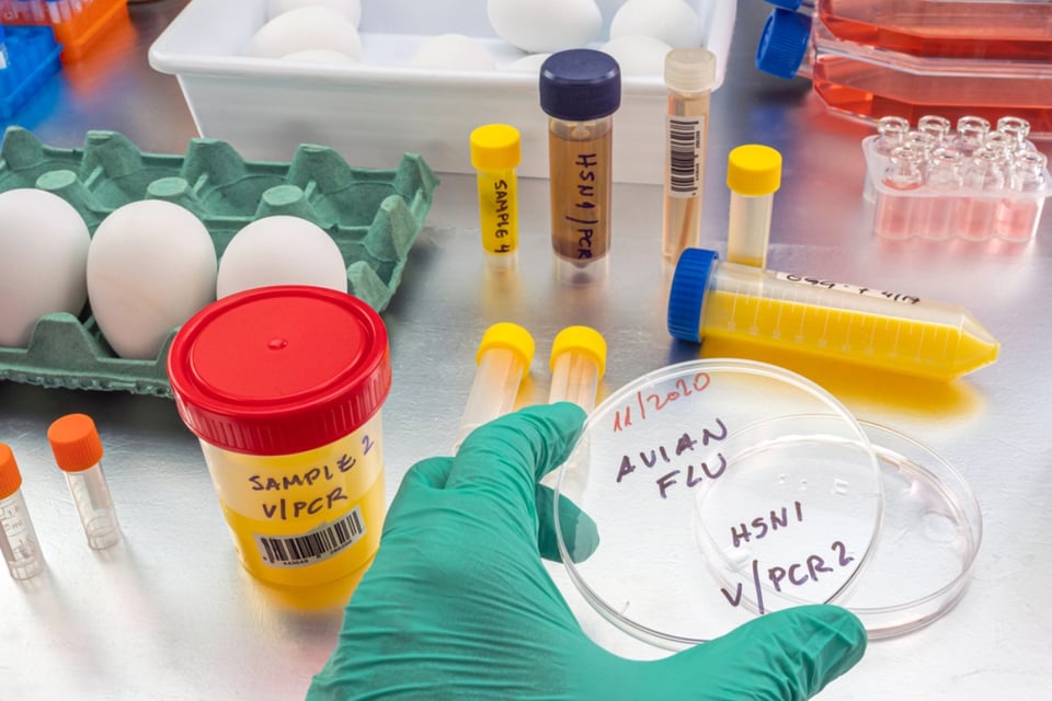 First human case of avian flu reported in Texas