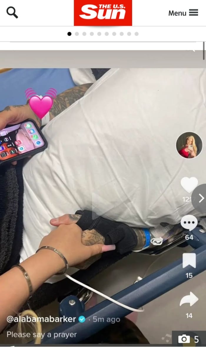 Revelan estado salud Travis Barker
