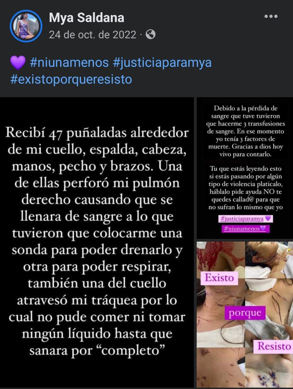 La mexicana Mya Saldaña sobrevivió el brutal ataque de 47 apuñaladas