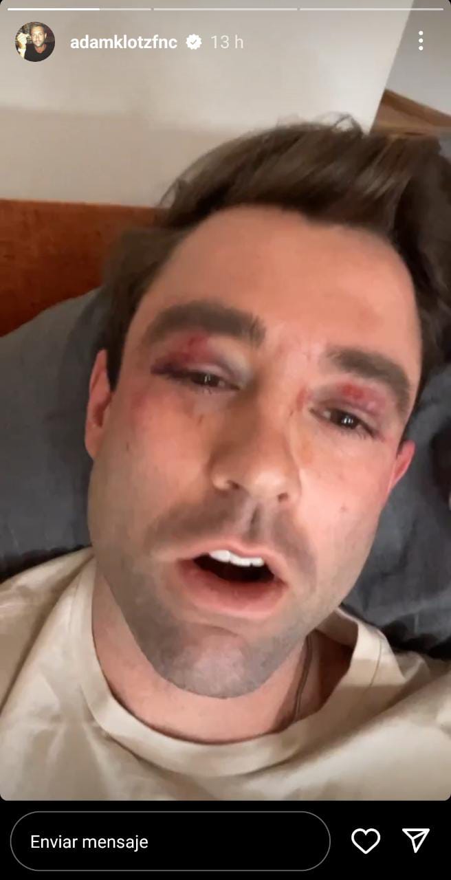 Adma Klotz, el hombre del clima de Fox News trató de hacer una buena acción y terminó con él en el suelo