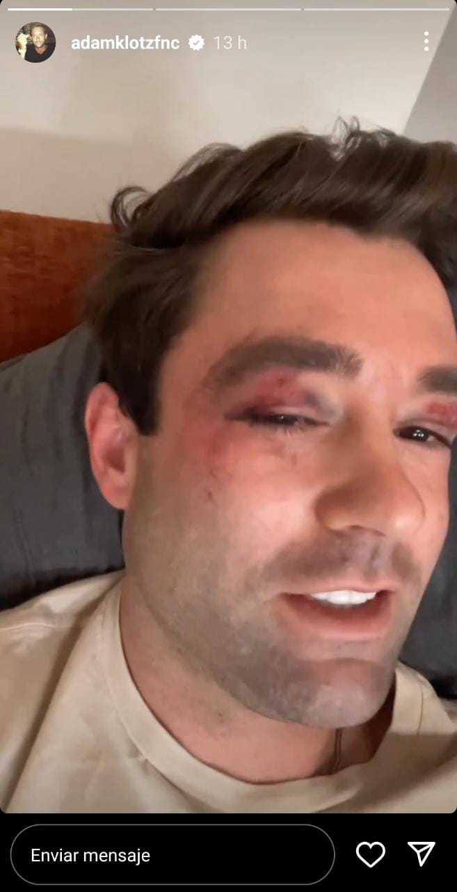Meteorólogo de Fox News, Adam Klotz fue atacado por un grupo de personas la noche del sábado