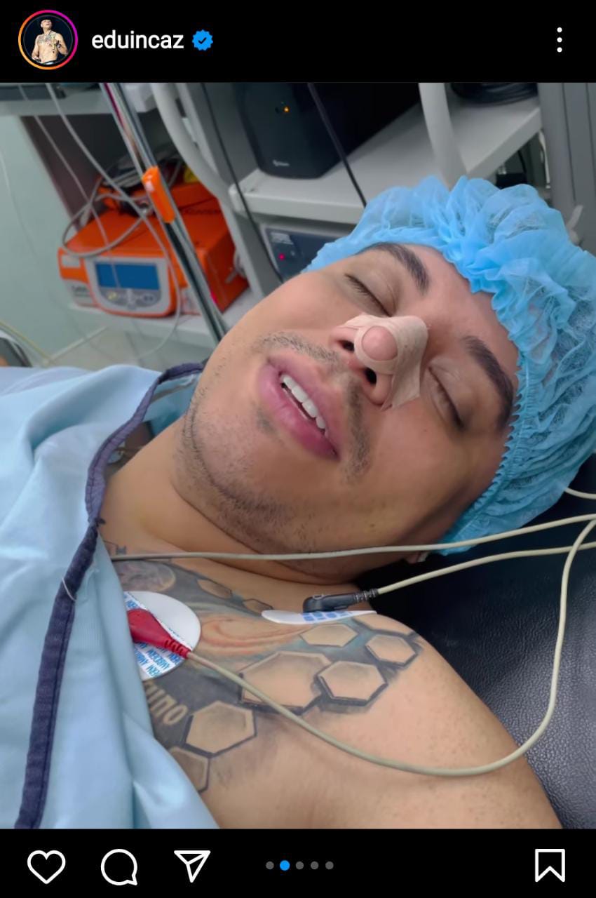 Eduin Caz sorprendió al aparecer en la plancha del quirófano