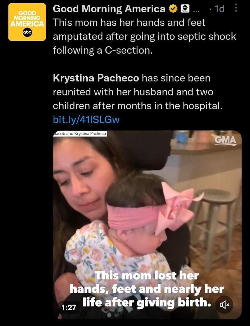 Tras choque séptico amputaron manos y pies de madre hispana