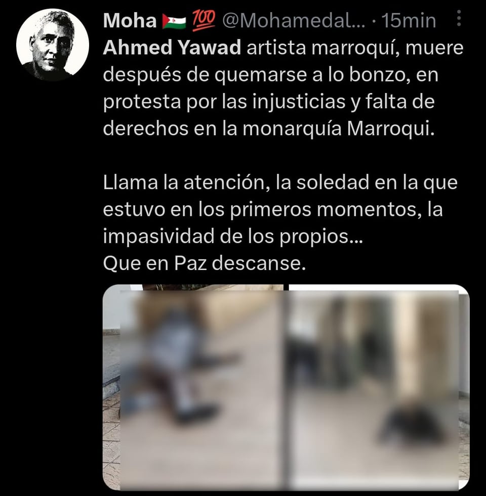 Presentes trataron de ayudarlo a sofocar el fuego