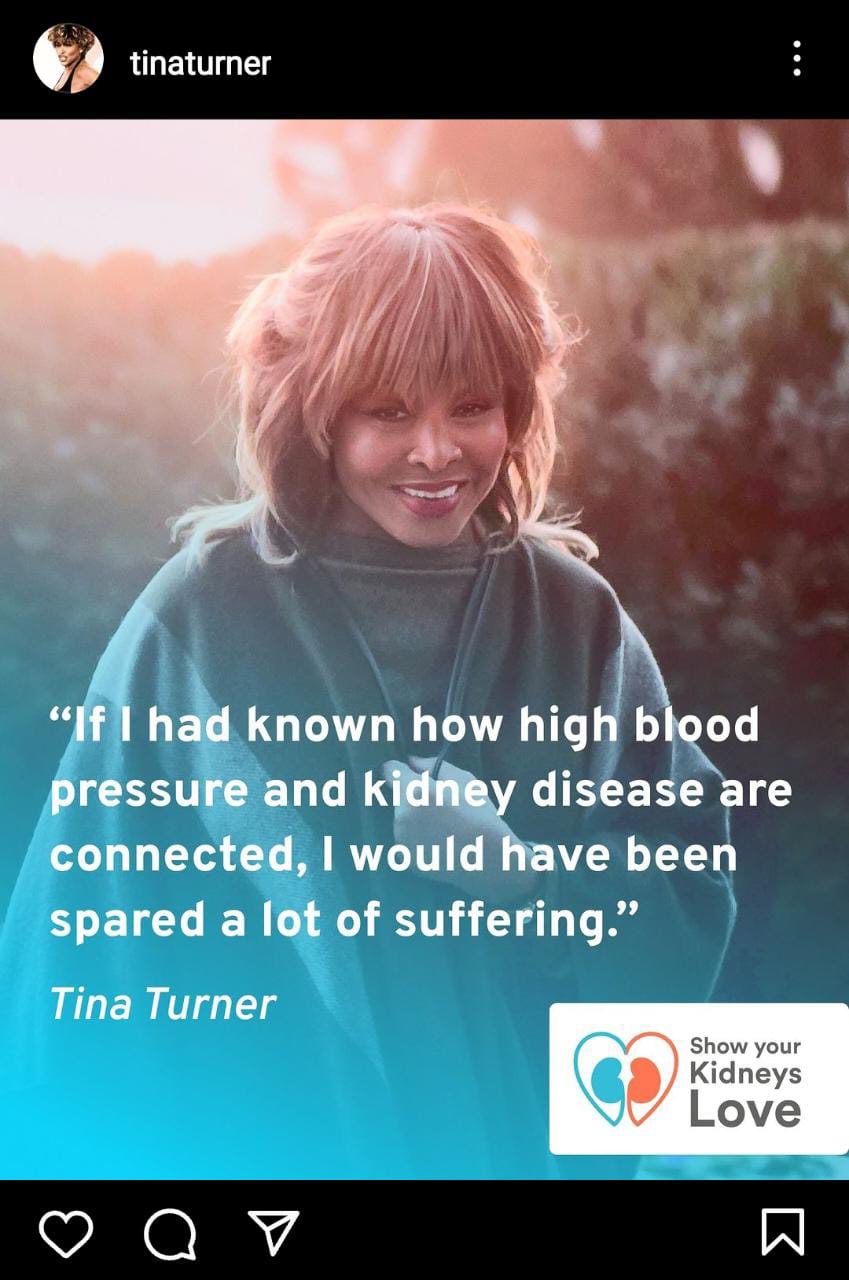 Sale a la luz el último mensaje de Tina Turner