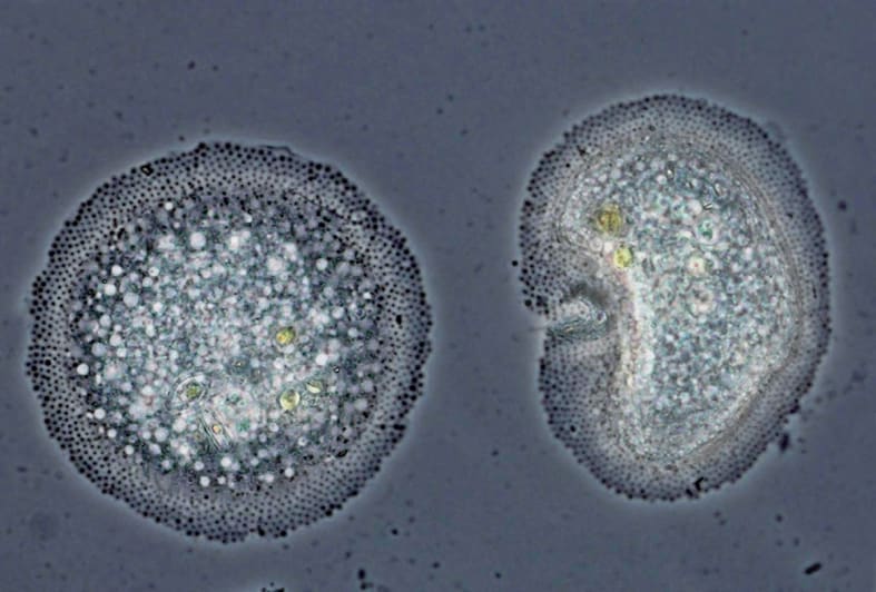 Florida man dies after falling ill with brain-eating amoeba