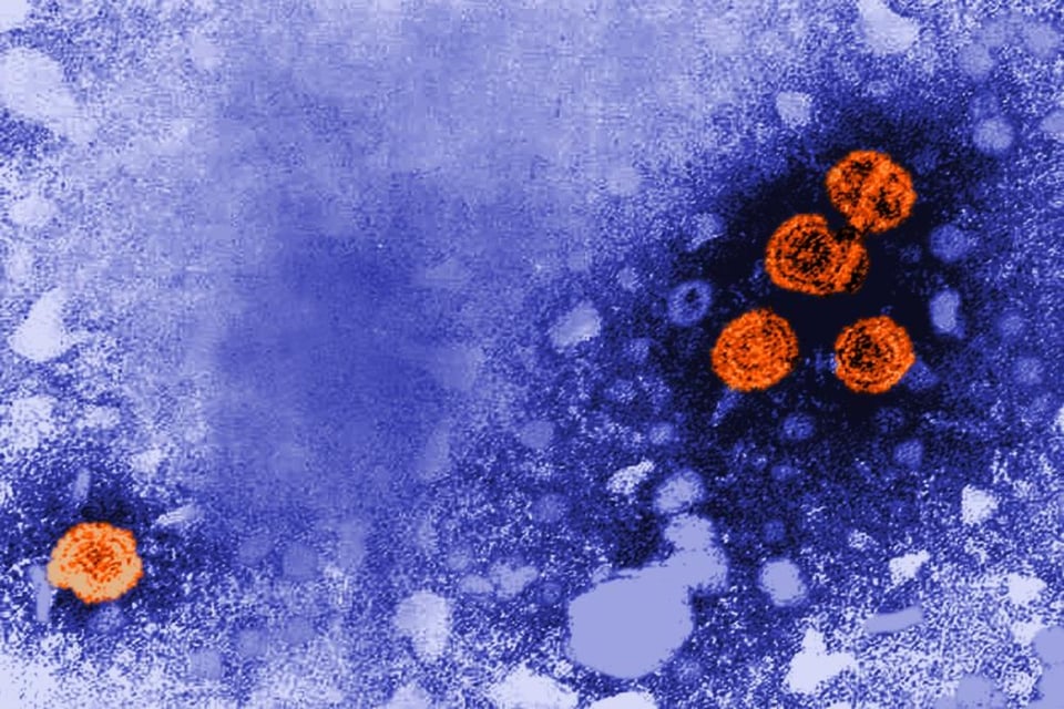 Muere niño de 3 años en México y  temen hepatitis aguda