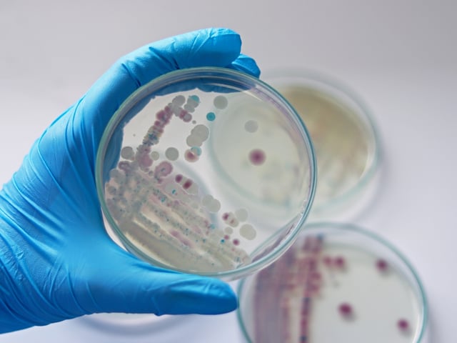 Flesh-eating bacteria causes panic in the US