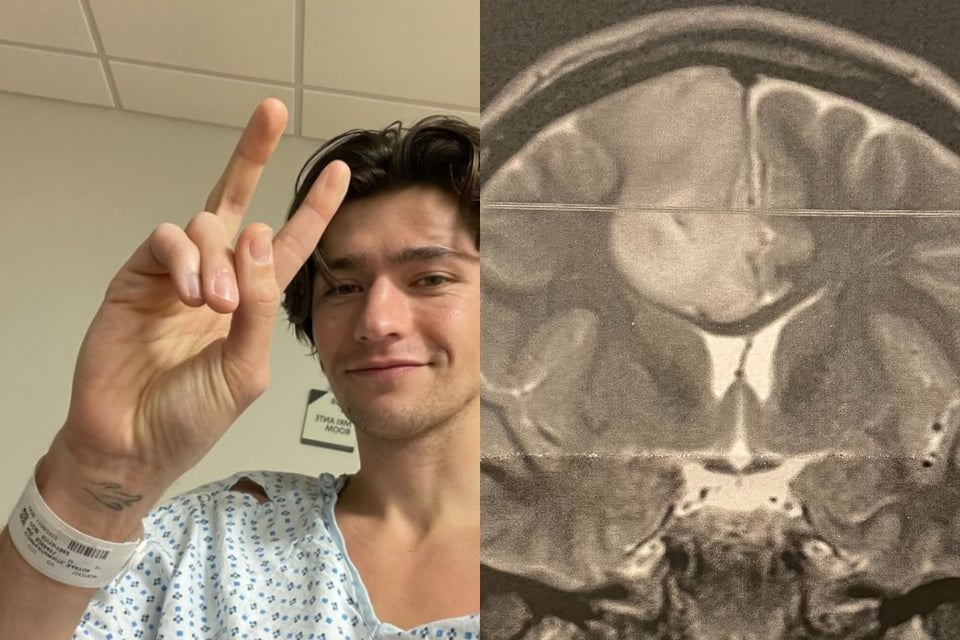 El actor de Netflix, Barton Cowperthwaite revela que padece cáncer en etapa 2