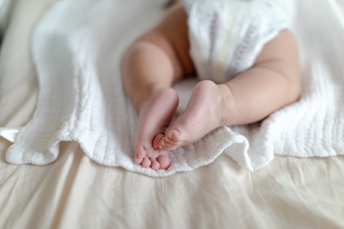 Un bebé nació con dos caras, cuatro brazos y cuatro piernas; ¿logró sobrevivir?