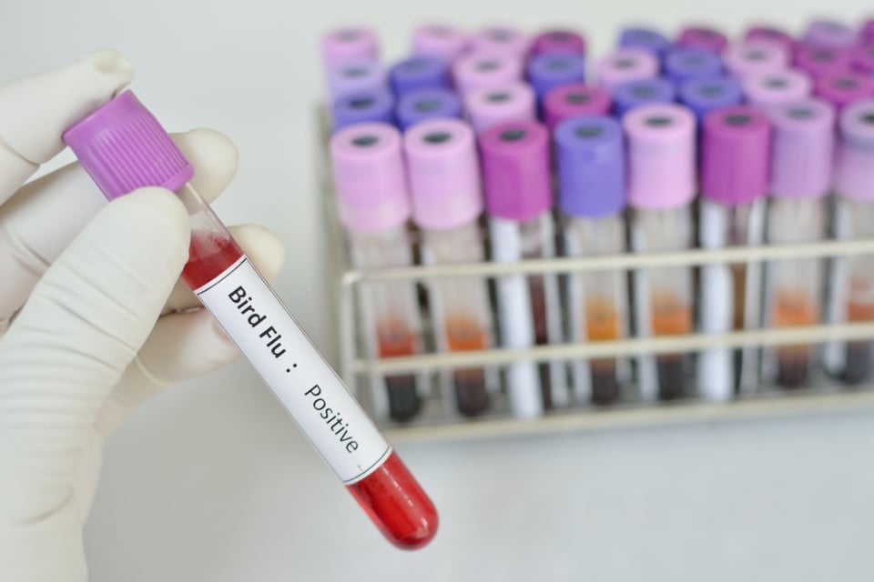 CDC alerta gripe aviar, gripe aviar, H5N1, CDC, Estados Unidos, salud pública, enfermedades infecciosas, MundoNOW