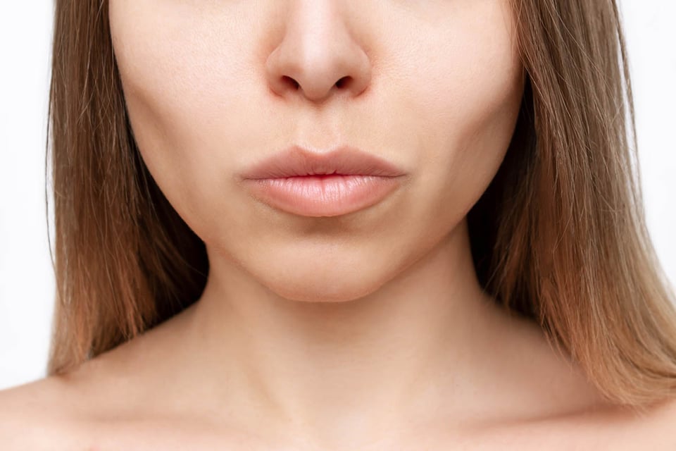 buccal fat removal, woman, face, beauty, skin, cosmetic surgery