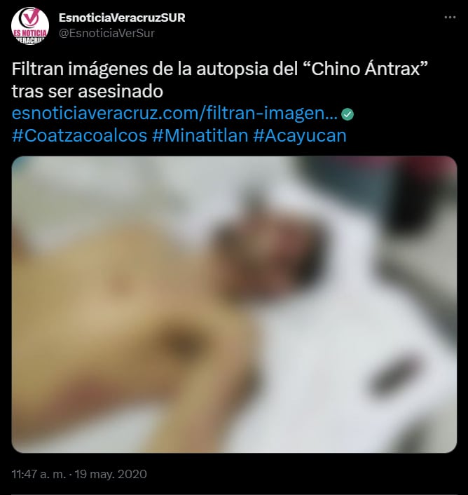 The autopsy of the Chinese Anthrax