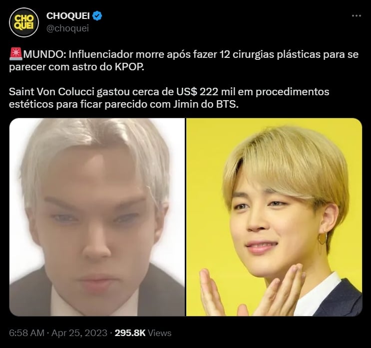 El representante del actor afirma que era muy inseguro con su apariencia
