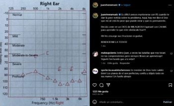 Juan Rivera recibe la peor noticia sobre su problema de salud en el oído
