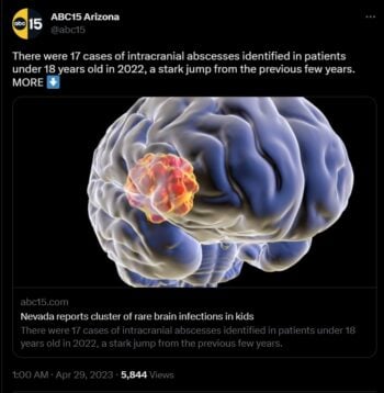 ¿Qué causa el misterioso brote de infecciones cerebrales en niños de Nevada?