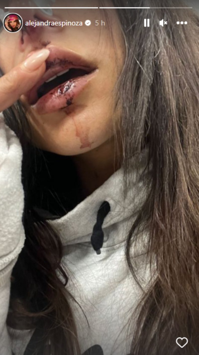 "Tan feo que duele"
