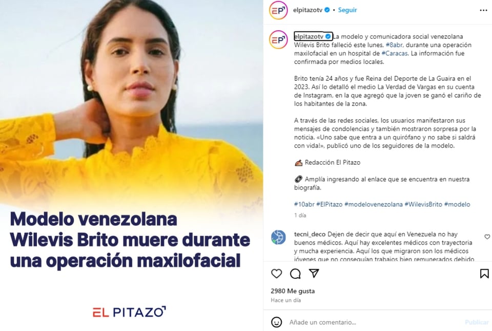 Muere modelo Wilevis Brito, Venezuela, muerte, cirugía, luto, MundoNOW