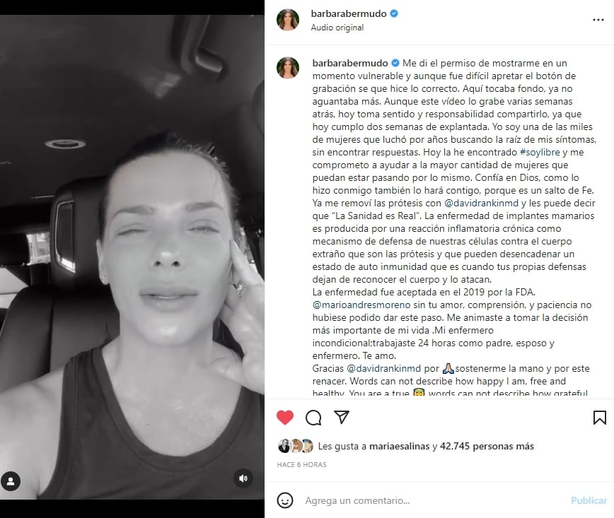 Bárbara Bermudo breast prosthesis: Breaks down in tears