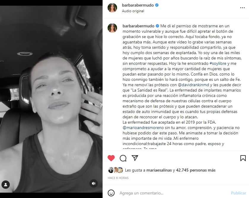 Barbara Bermudo breast prosthesis: "I know I did the right thing.