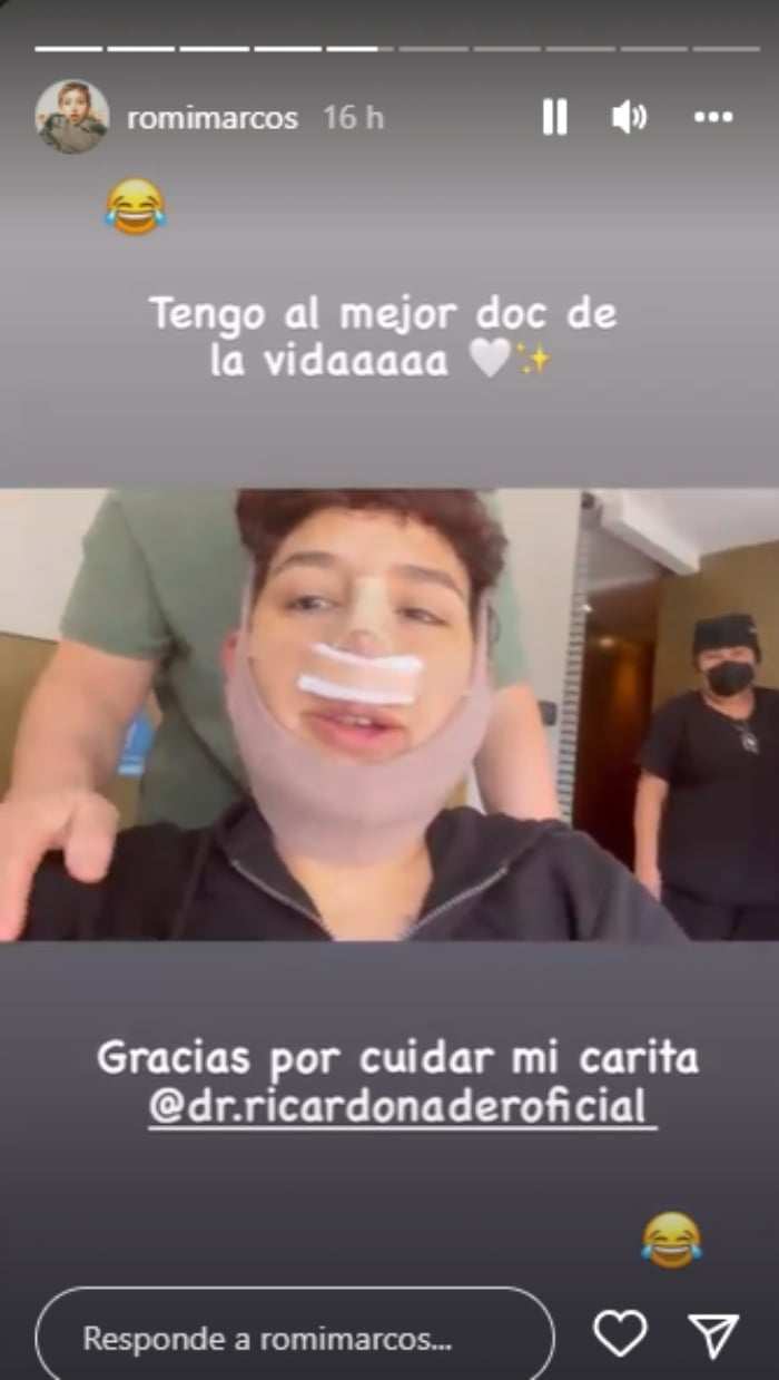 Romi Marcos cirugía estética