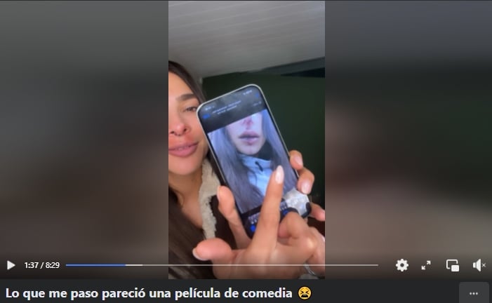 Alejandra Espinoza shows her disfigured face