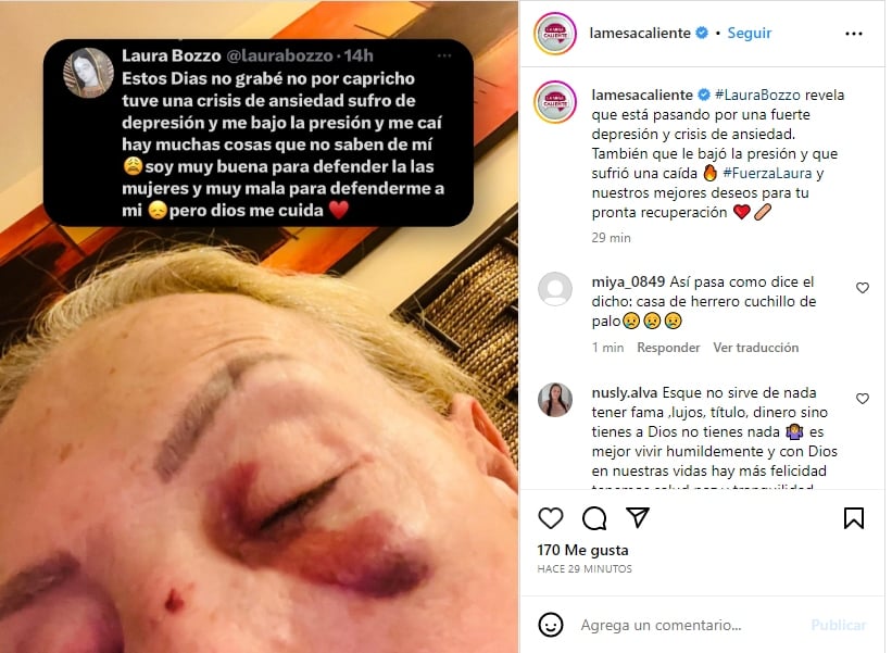 Laura Bozzo aparece con golpes en el rostro