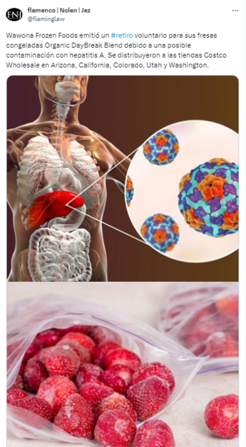 ¿Qué es la hepatitis A?