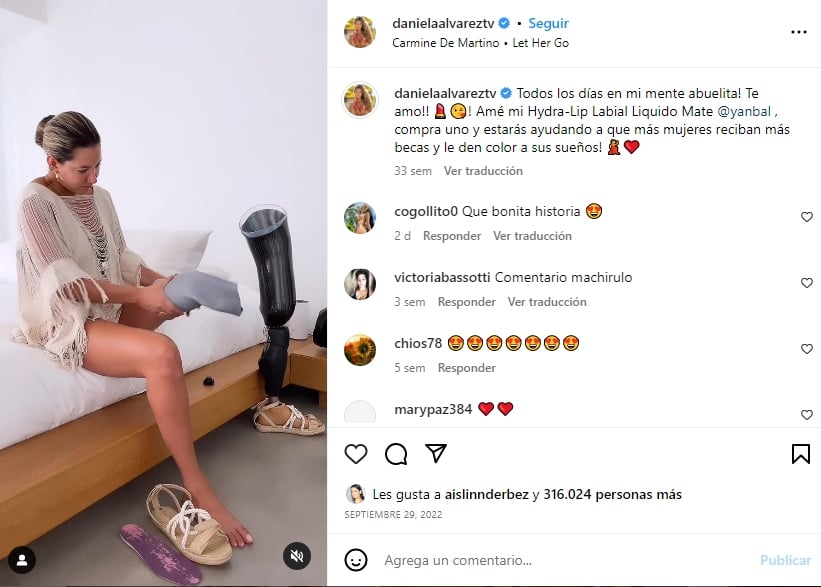 Daniela Álvarez was bitten by an animal