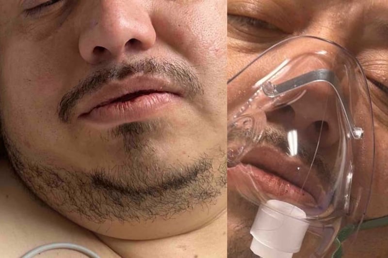 Mexicano pierde su hogar mientras se sometía a una cirugía de columna