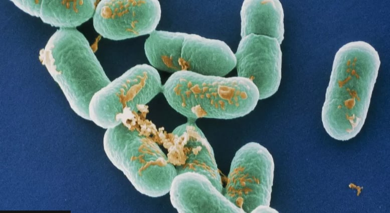 Authorities report listeria outbreak in the US