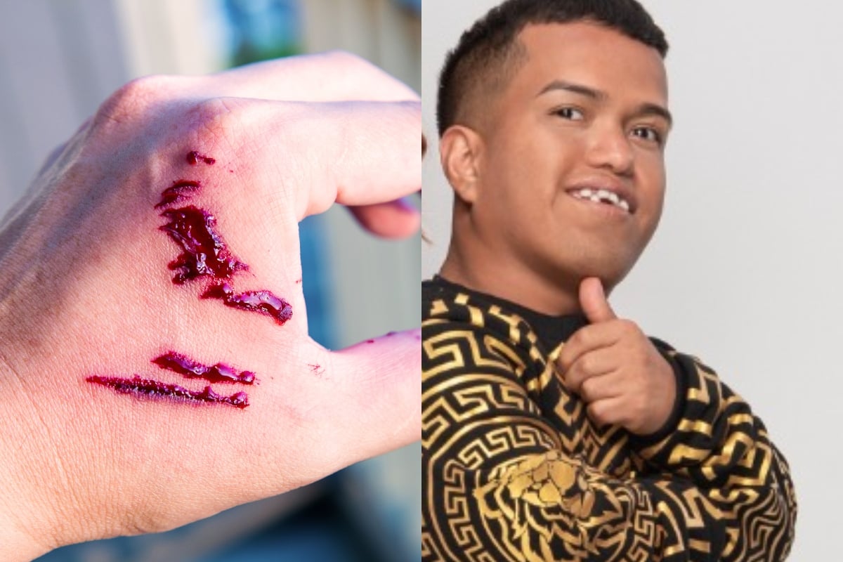 They report that Medio Metro was bitten by a rabid dog