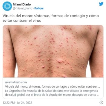 ¿Qué hacer para evitar contagiarte de la viruela del mono?