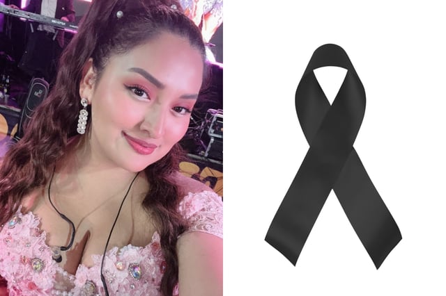 They show the last images of Muñequita Milly before she died after cosmetic surgery