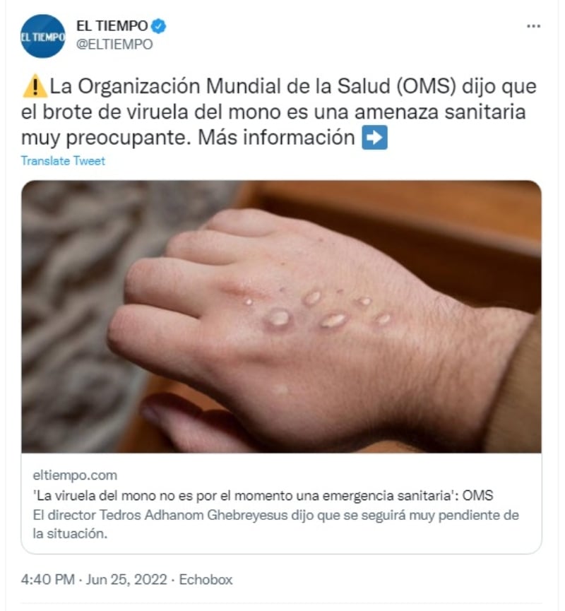 OMS dice la verdad sobre la viruela del mono