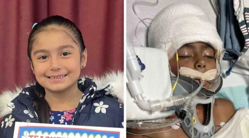 Niña hispana atacada por pitbulls lucha por su vida