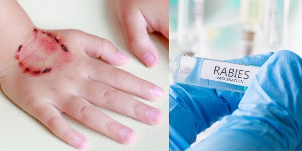 Bat infected with rabies found in Michigan