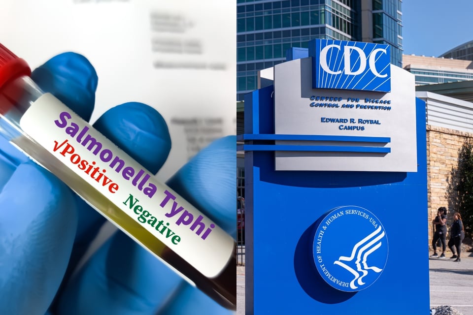 Los CDC investigan preocupante brote de salmonella en 29 estados