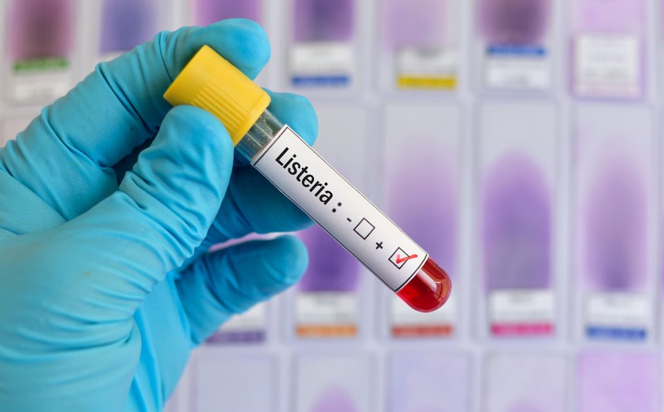 ¿Qué es la Listeria?