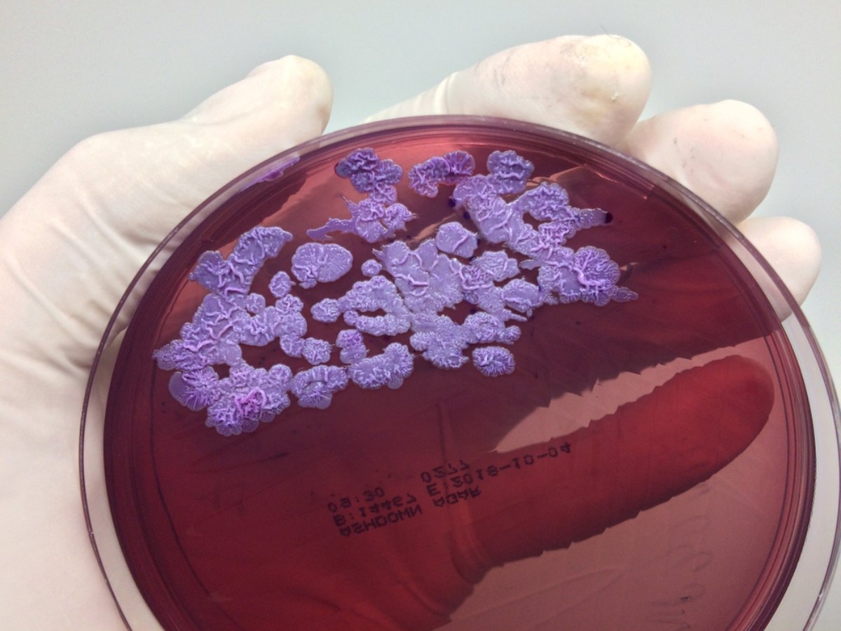 Bacteria that can cause deadly infections found in US soil and water for the first time